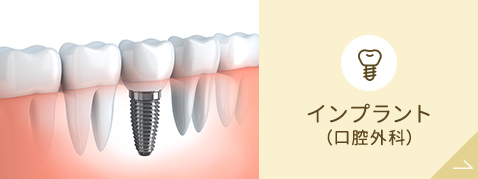 インプラント