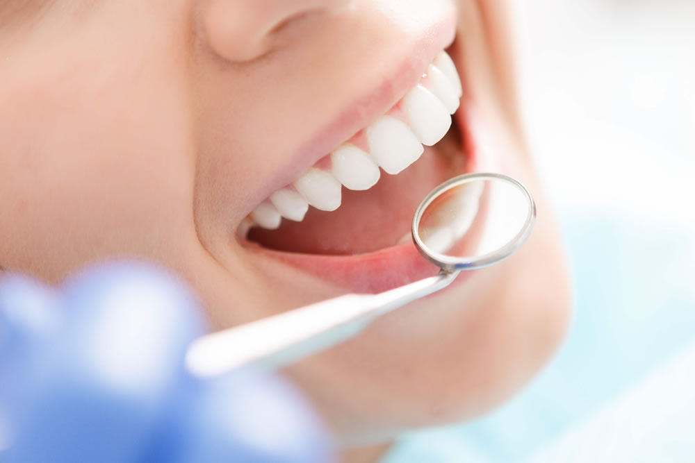 予防歯科の習慣化